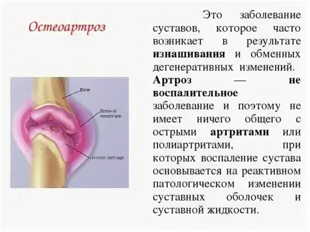 Артрит артроз остеопороз. Деформирующий остеоартроз тазобедренного сустава ii степени. Разница между артритом и артрозом. Деформирующий остеоартрит остеоартроз. Синовиальная оболочка коленного сустава.
