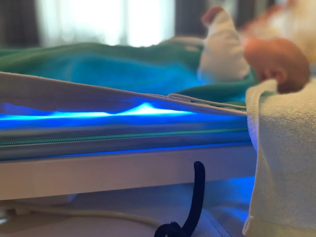 УФ лампа от желтушки. Ультрафиолетовая лампа для новорожденных от желтушки. Лампа кокон от желтушки. Лежачая лампа от желтушки. Прокат ламп