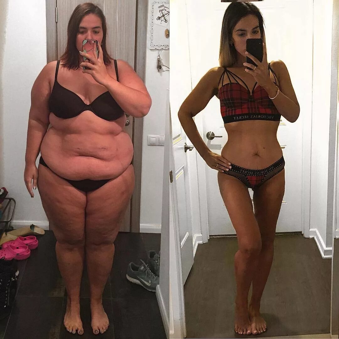 Похудение до и после. Лилия нилова до и после похудения. Сильное похудение. Как похудеть со 100 кг. Похудение до и после.