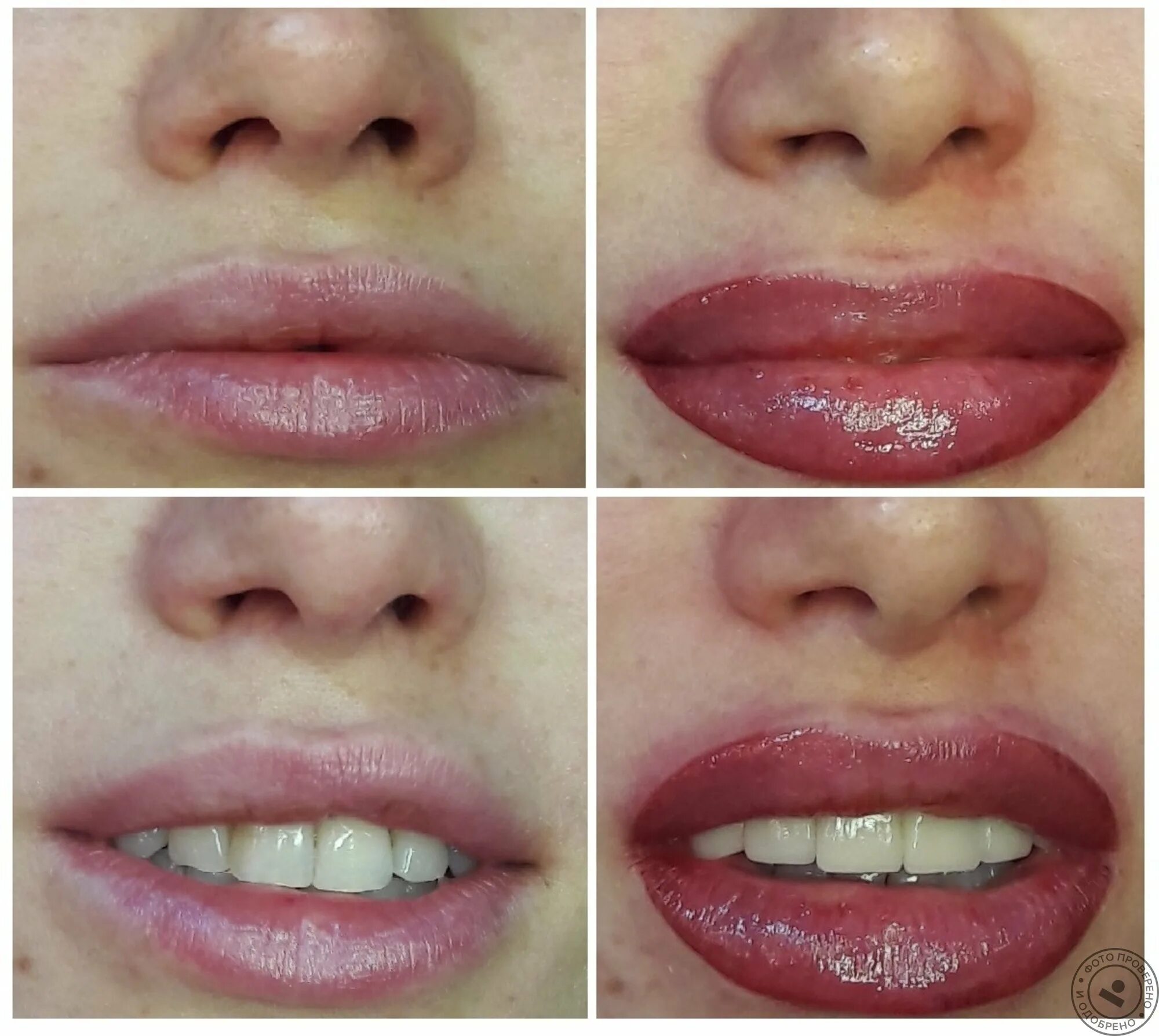 Увеличение губ стоматолог. Татуаж губ. Перманент губ. Перманентный макияж губ. Татуаж губ до и после.