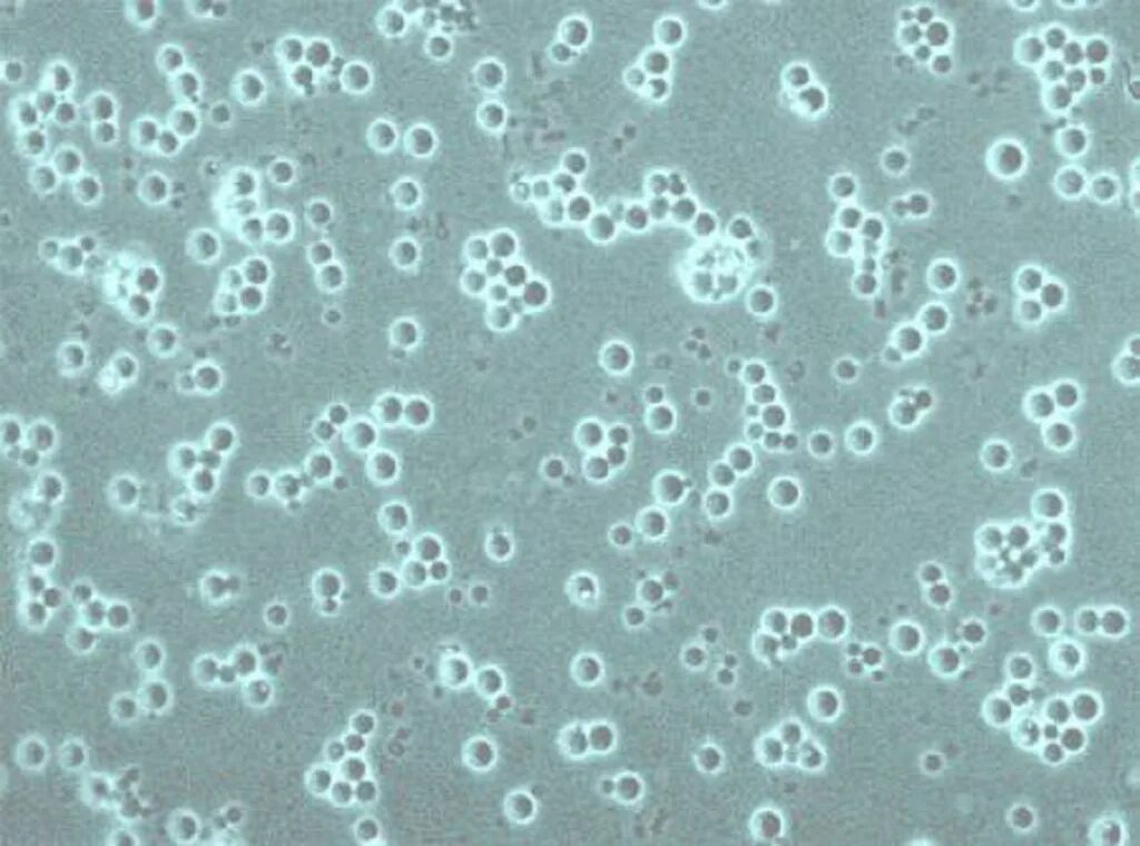 Дрожжеподобные грибы в моче. Дрожжеподобные грибы в моче. Дрожжевые грибы в моче микроскопия. Дрожжевые грибки в моче. Дрожжеподобные грибы в моче.