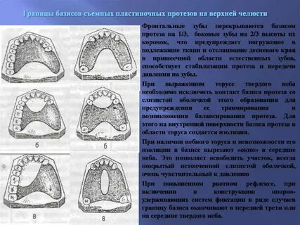 Пластмассовые коронки клинико лабораторные этапы