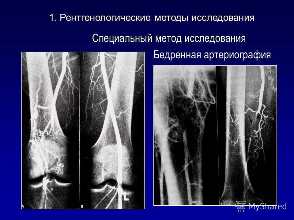 Исследование костно суставной системы. Методы изучения костной системы. Схема обследования костно мышечной системы. Методика исследования костно-суставной системы. Лучевая диагностика суставов.