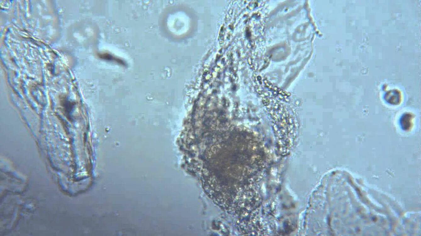 Слюна под микроскопом. Слюни под микроскопом. Микробы в слюне под микроскопом. Ротовая жидкость под микроскопом. Бактерии в слюне