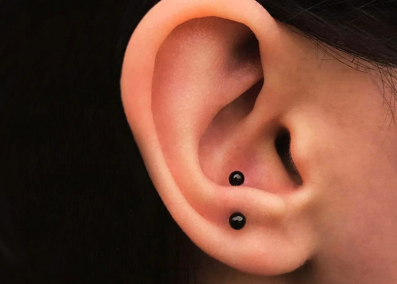 Козелок уха у ребенка. Козелок противокозелок уха.