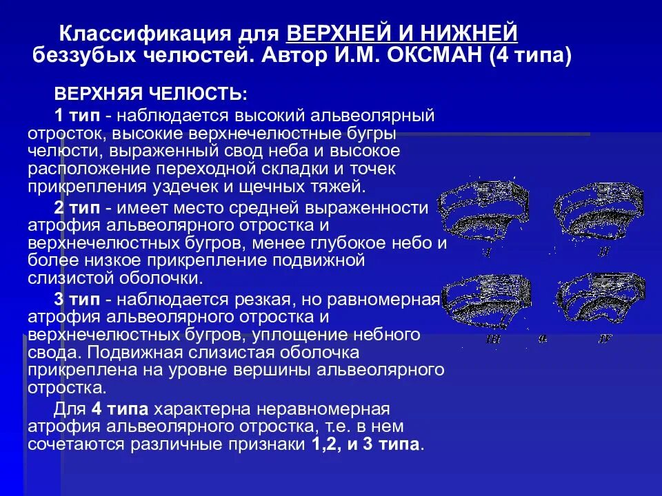 Оксман классификация беззубых челюстей. Классификация типов слизистой оболочки беззубых челюстей. Классификация беззубых челюстей по и.м. Оксману. Классификация Шредера беззубых челюстей. Неба свод предложения