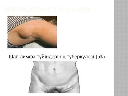 Әйелдердегі үлкен лабия туралы бейне