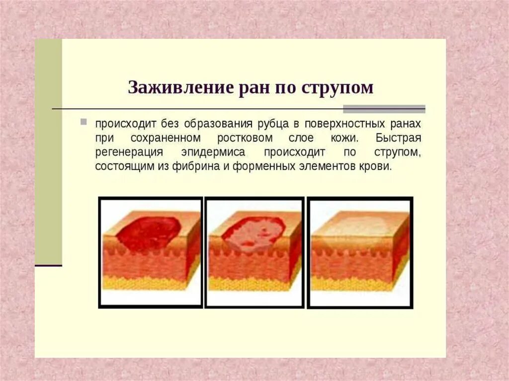 Как заживить быстрей