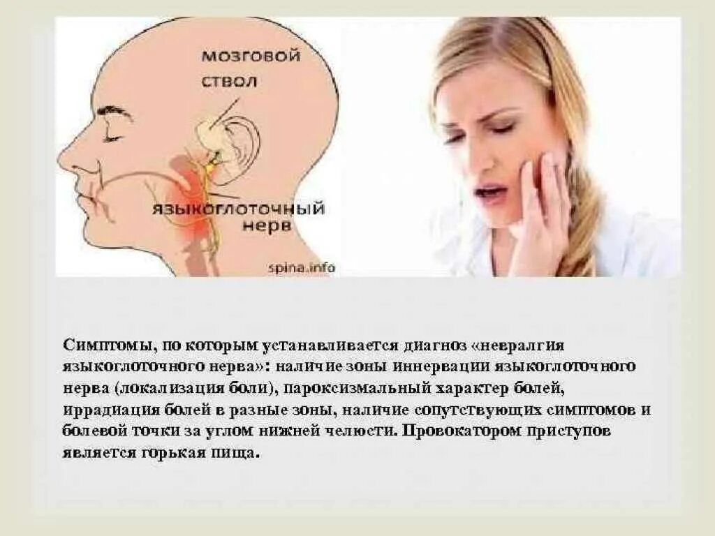 Болит горло уши и голова. Симптомы поражения языкоглоточного нерва. Симптомы нарушения функции языкоглоточного нерва. Клиника нарушения языкоглоточного нерва. Симптомы поражения языкоглоточного нерва неврология.