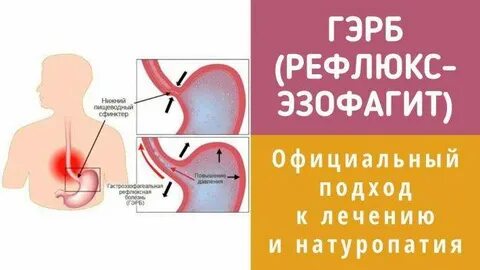 Эзофагит таблетки