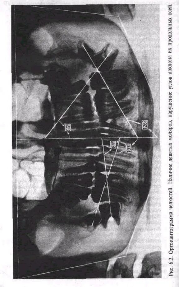 Подъязычная кость рентгенография. Панорамная рентгенография ног. Рентген с физиологической нагрузкой. Панорамная рентгенография укороченная нога.