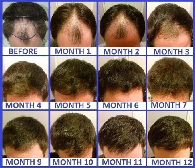 After three months