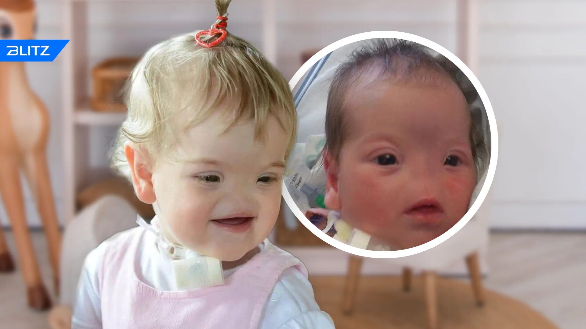 Архиния тесса. Девочка без носа. Девочка родилась без носа. Девочка без носа. Тесса эванс.