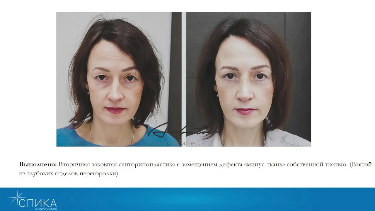 Арбатов работы. Доктор арбатов пластический хирург. спика пластическая хирургия.
