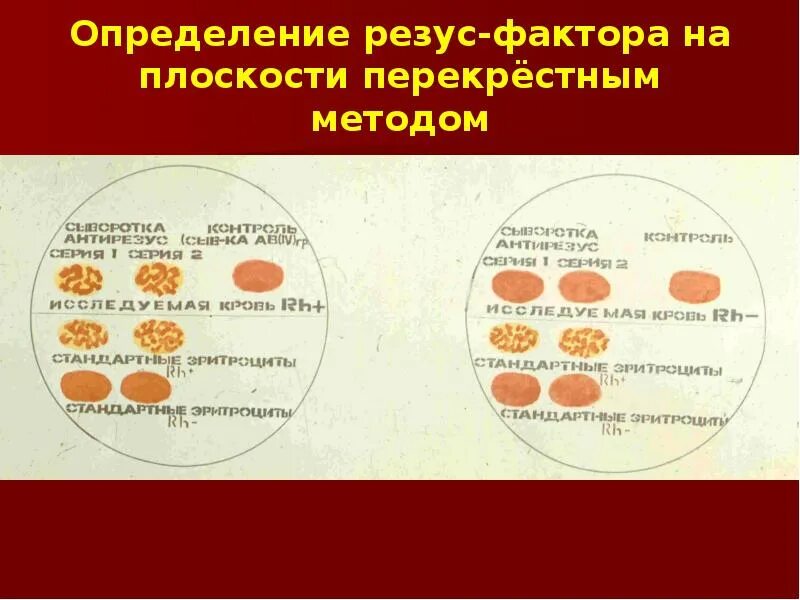 Перекрестный способ определения группы крови. Определение резус фактора. Методика определения резус фактора. Группа крови перекрестный метод. Резус фактор гемотест