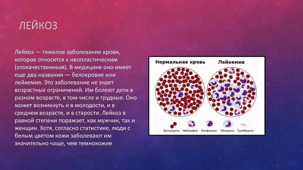 Какие признаки заболевание крови. Лейкоз клетки крови. Тромбоцитарный лейкоз. Злокачественные заболевания крови.