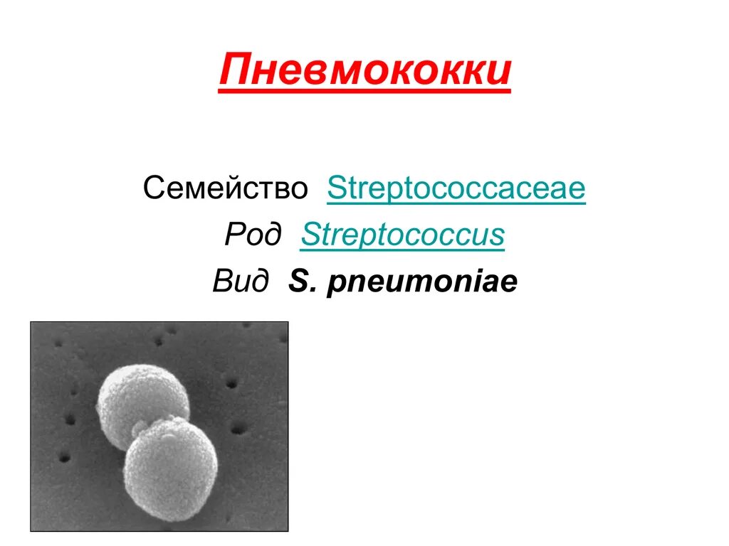 Стрептококки представители. Стрептококк пневмококковый. Пневмококк инфекция. Streptococcus pneumoniae микробиология.