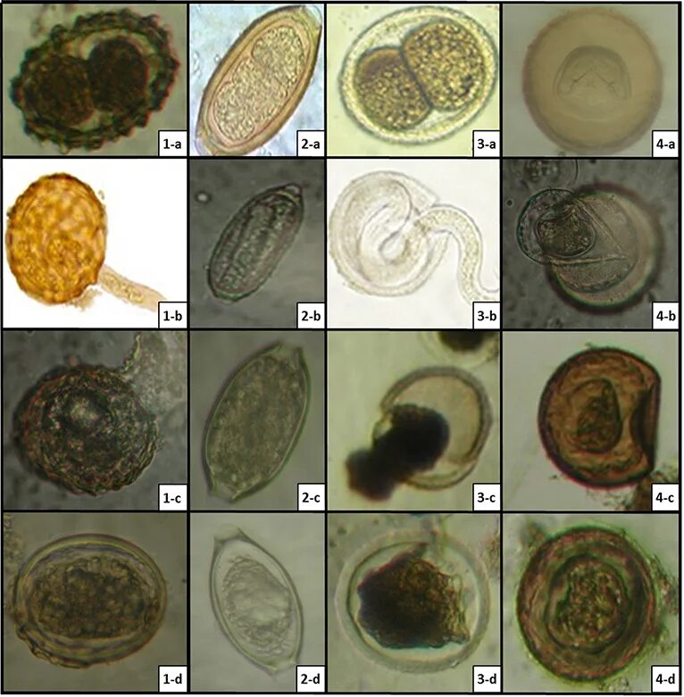 Яйца аскарид микроскопия. Аскаридоз яйца в микроскоп. Купить яйца глист