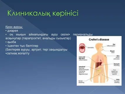 Рим патшайымы секс онлайн