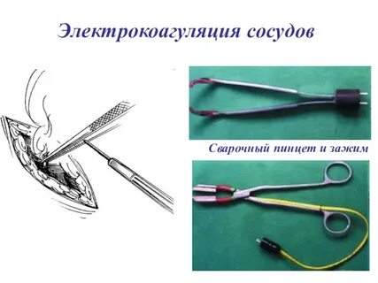 Кулинарка 1 где лежит пинцет