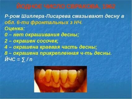 Проба шиллера писаревой