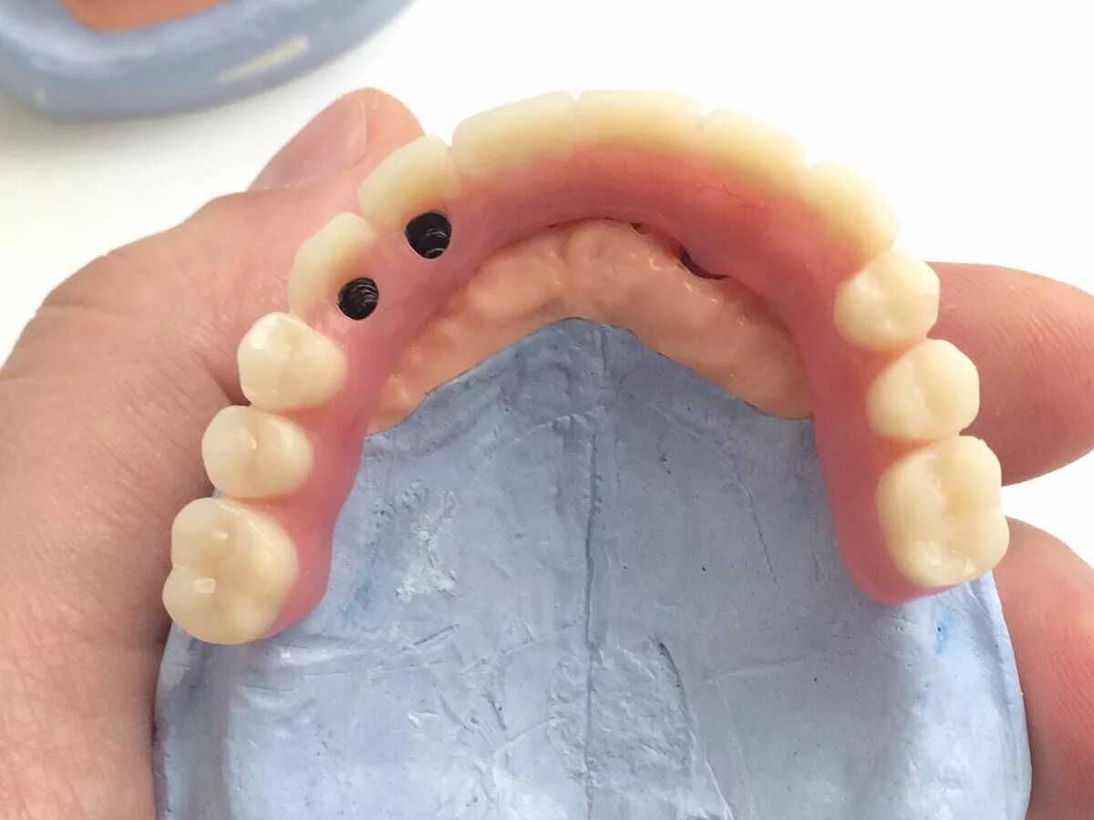 зубные протезы без неба москва