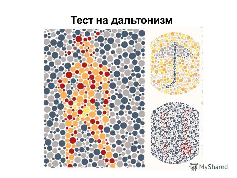 наследование дальтонизма у человека. дальтонизм задачи по генетике. женщины болеют дальтонизмом. дальтонизм. женщина дальтоник вышла.