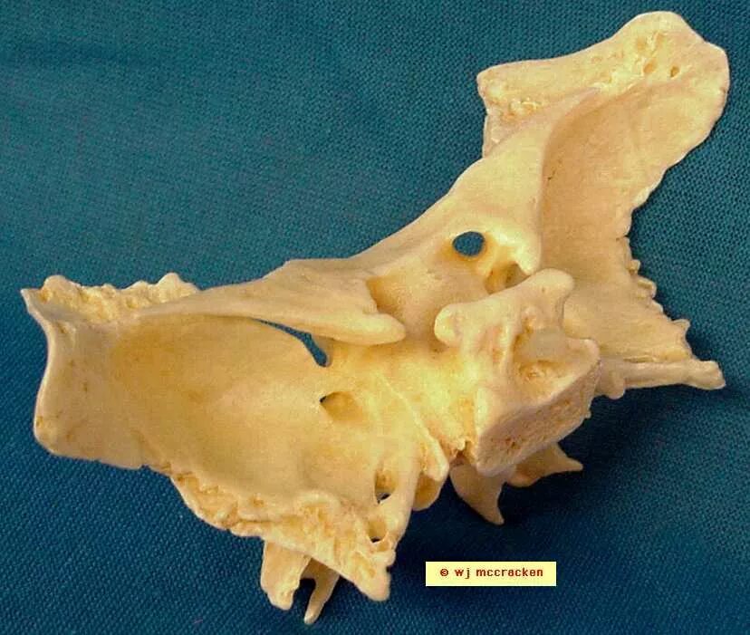 Турецкие седло кость. Клиновидная кость черепа турецкое седло. Sphenoidal Bone. Клиновидная кость настоящая. Sella Turcica на клиновидной кости.