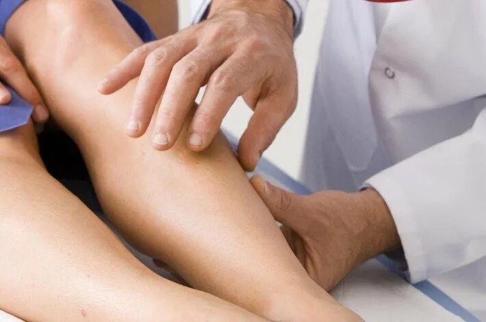 к какому врачу обращаться при варикозе. массаж при варикозном расширении вен. варикозное расширение вен профилактика. варикоз вен нижних конечностей. тромбофлебит нижних конечностей.