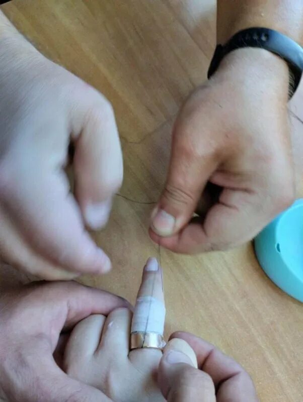 Как снять кольцо с уздечки Как снять кольцо с палец руки
