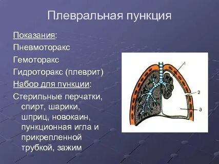 Прокол при пневмотораксе