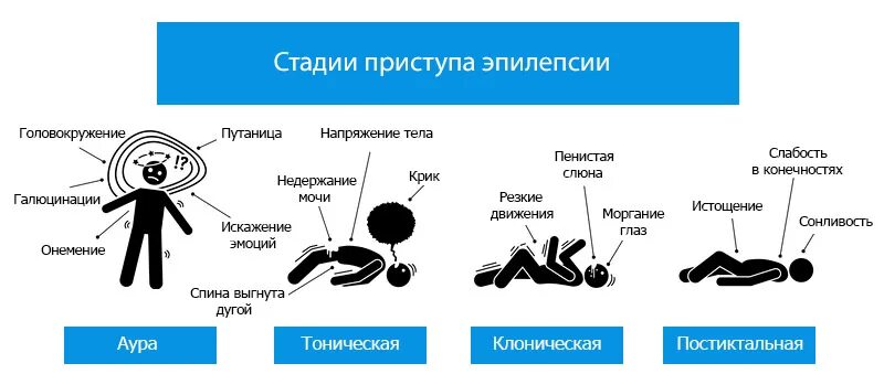 Симптомы эпилепсии у мужчин. Приступ эпилепсии стадии. Фазы приступа эпилепсии. Фазы эпилептического припадка.