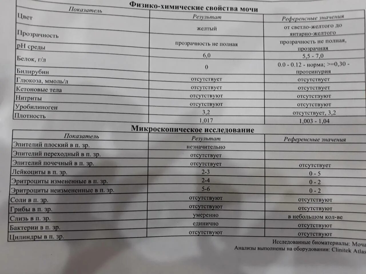 Эпителий какая норма. Норма слизи в ОАМ. Слизь показатель мочи. Норма слизи в моче у женщин. Микроскопическое исследование мочи бактерии.