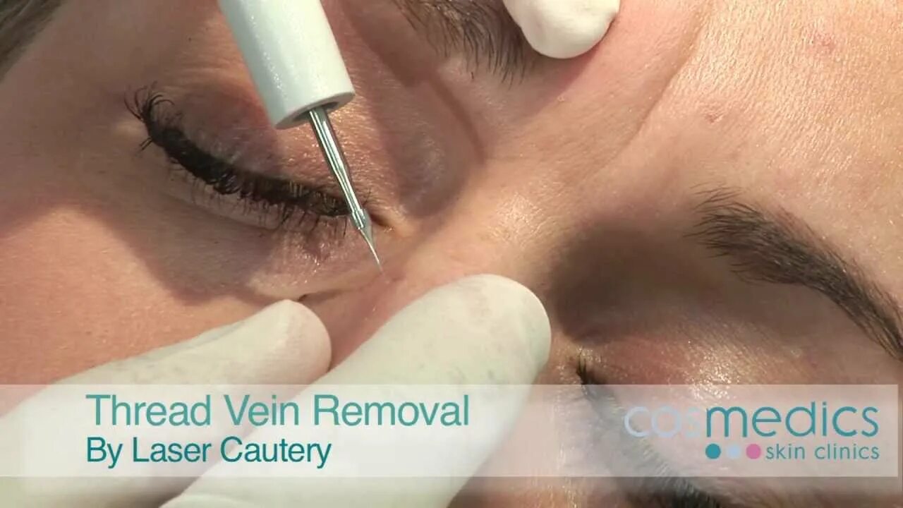 Remove thread. Remove thread