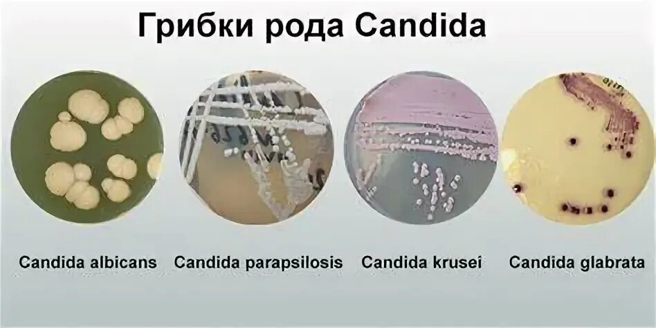 Анализ candida albicans