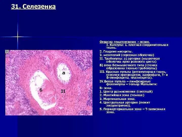 Селезенка описание. Селезенка окраска гематоксилин-эозином. Гиалиноз капсулы селезенки патанатомия. Селезенка гистопрепарат. Белая пульпа селезенки гистология.