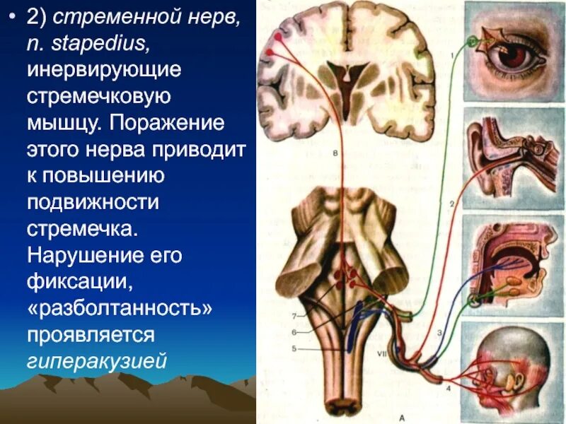 Приводящий нерв. Черепные нервы поражение. стременной нерв. поражение стременного нерва. стременной нерв (n. stapedius).