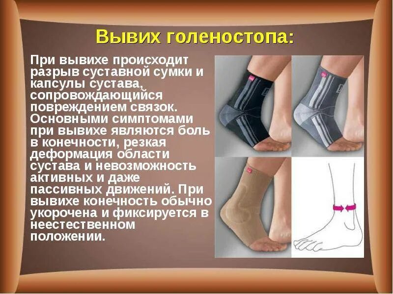 Симптомы растяжения голеностопного. Вывих голеностопного сустава. оказание первой помощи при вывихе голеностопа. выверхголеностопного сустава.