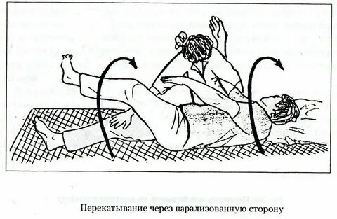 Массаж после инсульта как правильно видео