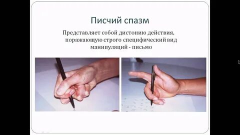 Писчий спазм