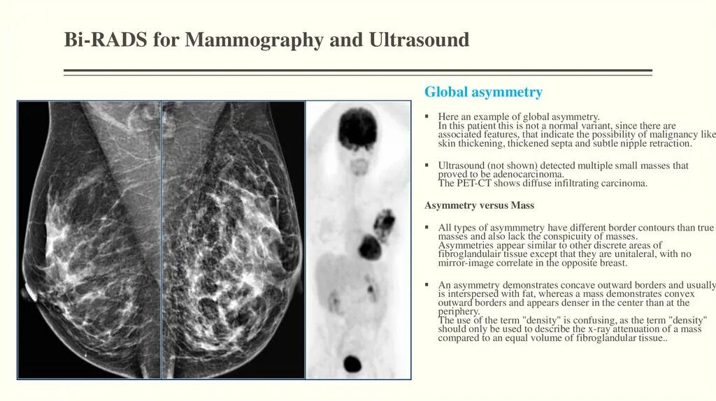 Классификация bi-rads молочных желез. ACR bi-rads. Мрт молочных желез bi-rads. Оценка маммограммы по системе bi-rads.