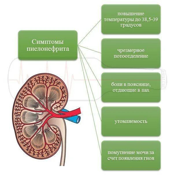 Признаки пиелонефрита почек