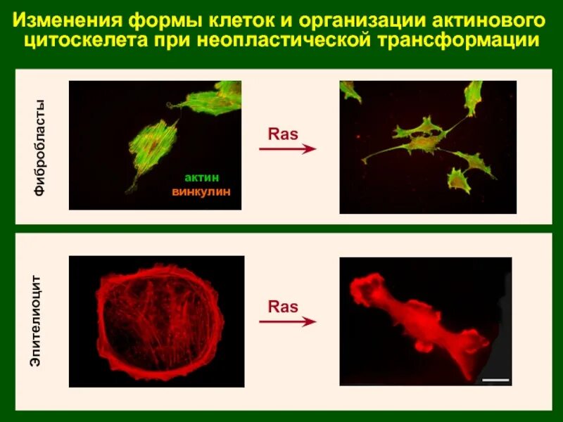 6 изменений. Неопластическая трансформация это. неопластические клетки. изменение формы клеток выполняет. формула неопластических изменений.