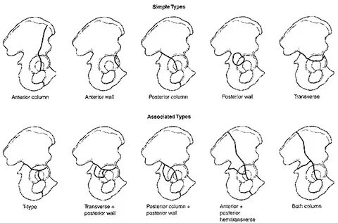 Associated types