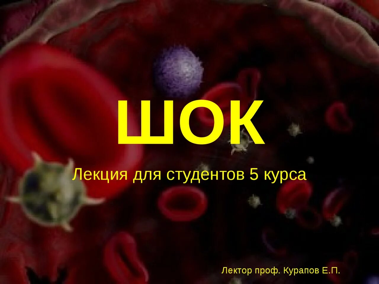 ШОК лекция. Лекция по шокам.