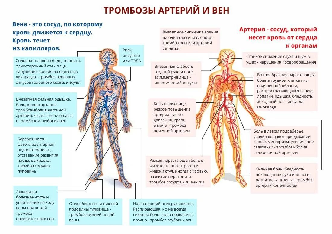 Причины тромбов симптомы. Артериальный и венозный тромбоз. Артериальная и венозная тромбоэмболия. Артериальный и венозный тромб.