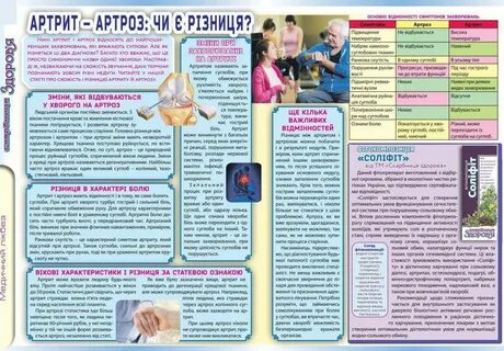 Артроз лечение профилактика