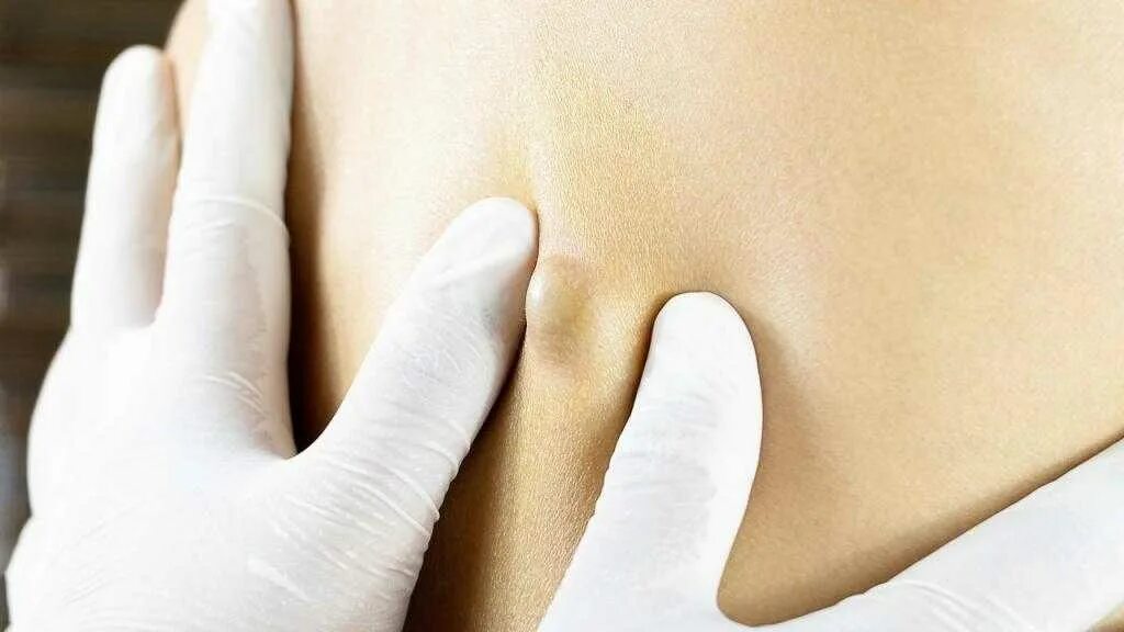 Гнойная хирургия операции. Отделение мягких тканей. Отделение мягких тканей. Носовой распатор двусторонний. Носовой распатор двусторонний.