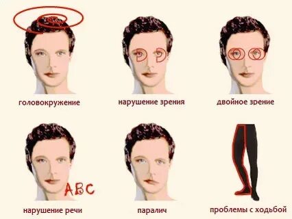 Зрение после инсульта