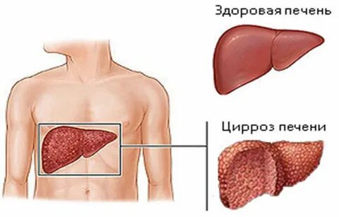 Где болеют здоровые